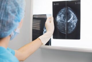O Goberno galego crea o Consello Técnico Asesor para a detección precoz de cancro