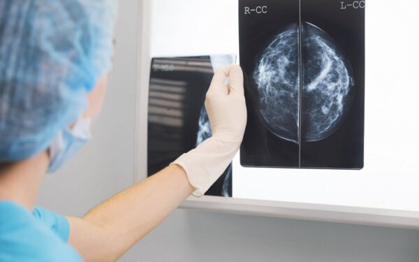 O Goberno galego crea o Consello Técnico Asesor para a detección precoz de cancro