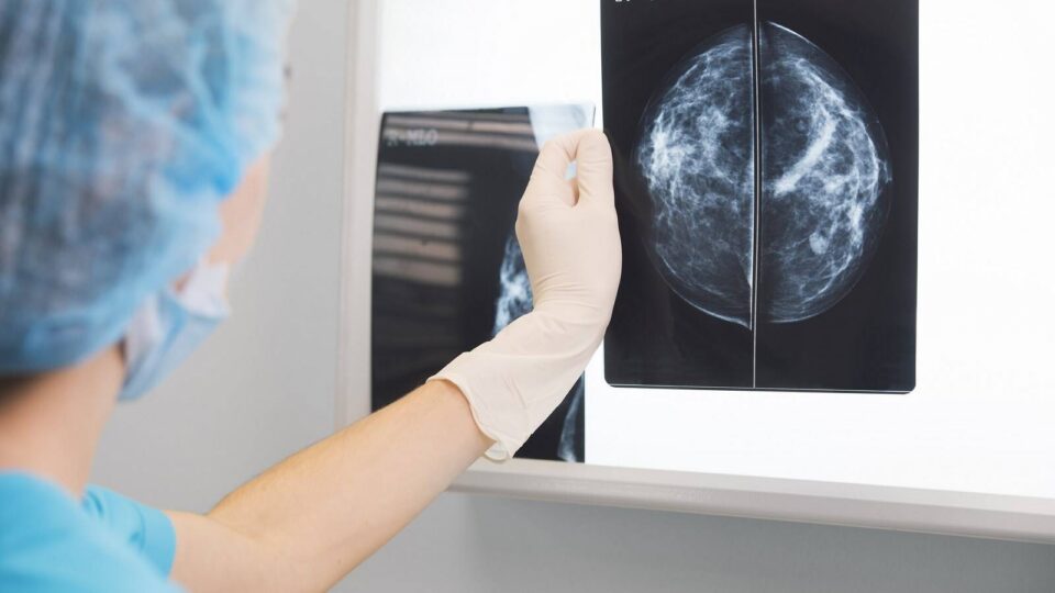 O Goberno galego crea o Consello Técnico Asesor para a detección precoz de cancro